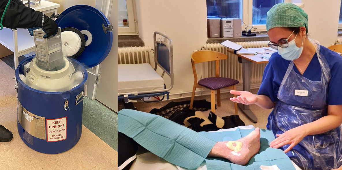 Rahime Inci, specialistläkare och medicinskt 
såransvarig på hudkliniken på Sahlgrenska 
Universitetssjukhuset, med den första studiedeltagaren.